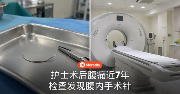 护士术后腹痛近7年 检查发现腹内手术针