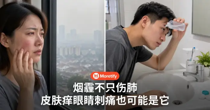 烟霾不只伤肺 皮肤发痒眼睛刺痛 也可能跟它有关