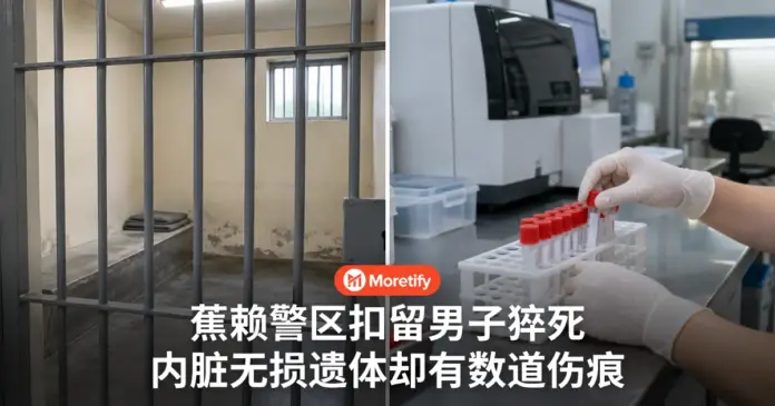 蕉赖警区扣留男子猝死 内脏无损遗体却有数道伤痕