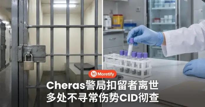 Cheras警局扣留者离世 身上多处不寻常伤势 CID受命彻查