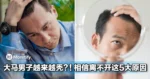 大马男子越来越秃?!相信离不开这5大原因...