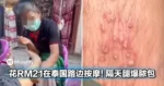 花RM21在泰国路边按摩，隔天腿爆脓包！医生警告「别为了省钱冒险」！