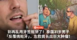 别再乱用牙签抠牙了！泰国31岁男子「反覆挑蛀牙」，左脸竟长出巨大肿瘤！